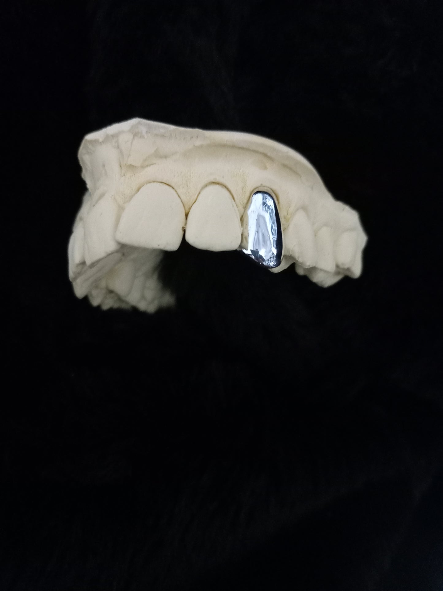 Custom solid cap grillz