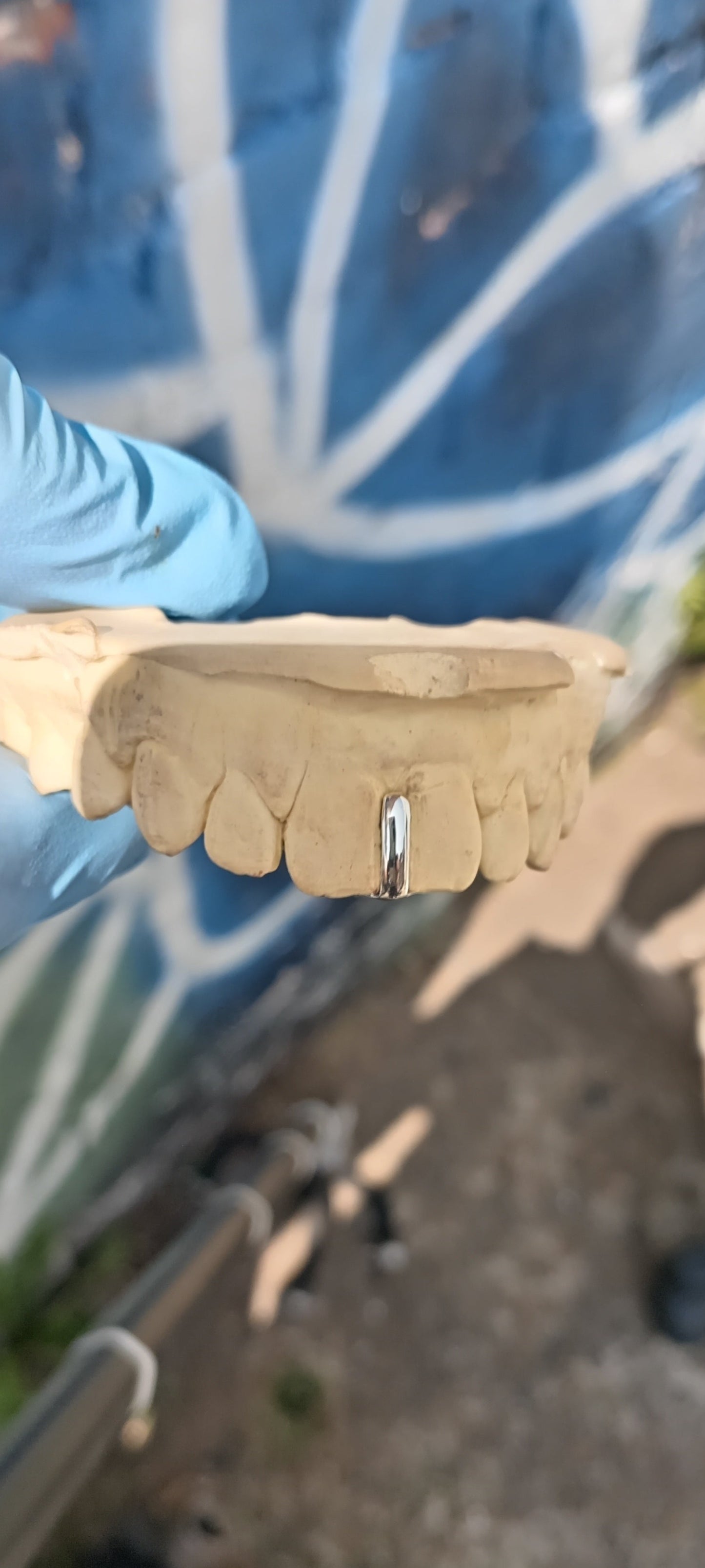 Custom made 925 silver gap filler grillz